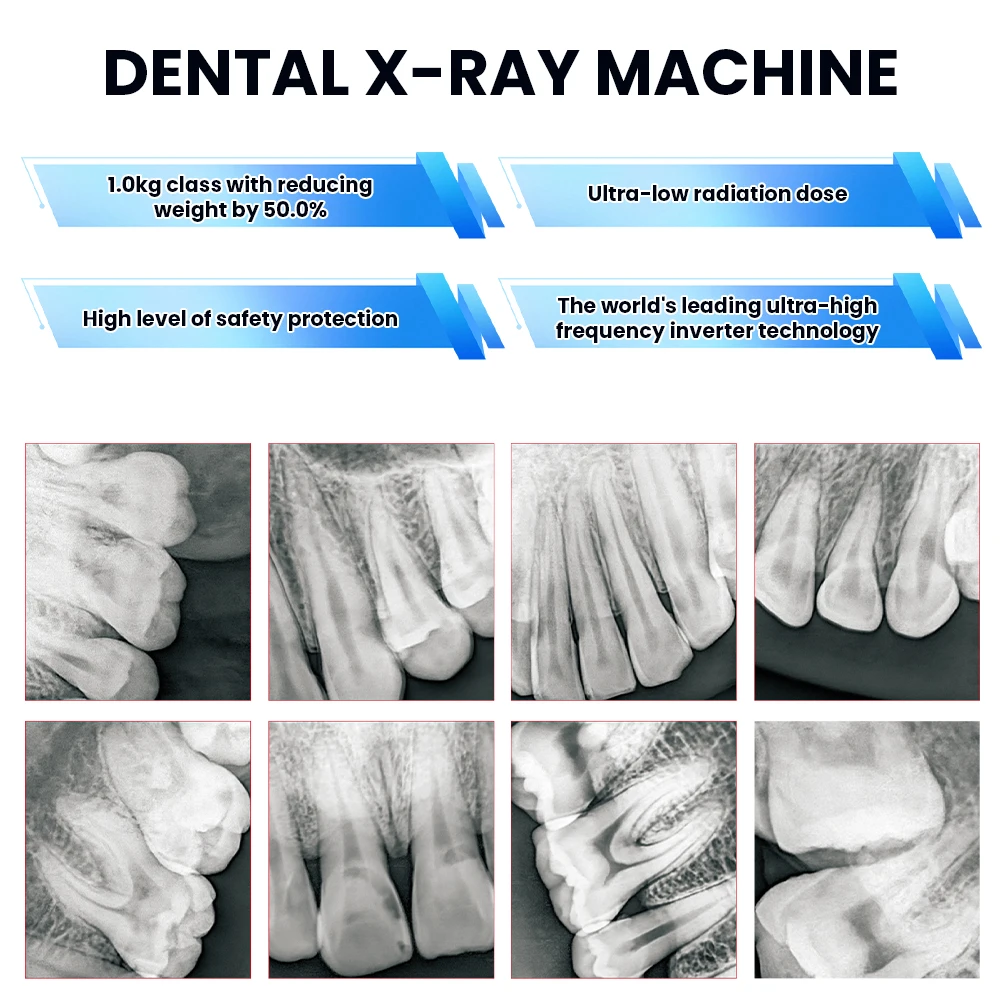 Touch Screen High Frequency X-Ray Generator Remote Controll High-quality Imaging  Low Radiation Exposure Dental X-ray Machine