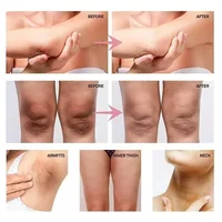 Lotion blanchissante pour le corps, éliminateur de taches foncées pour les aisselles, les genoux, les coudes, crème hydratante éclaircissante pour la peau 4