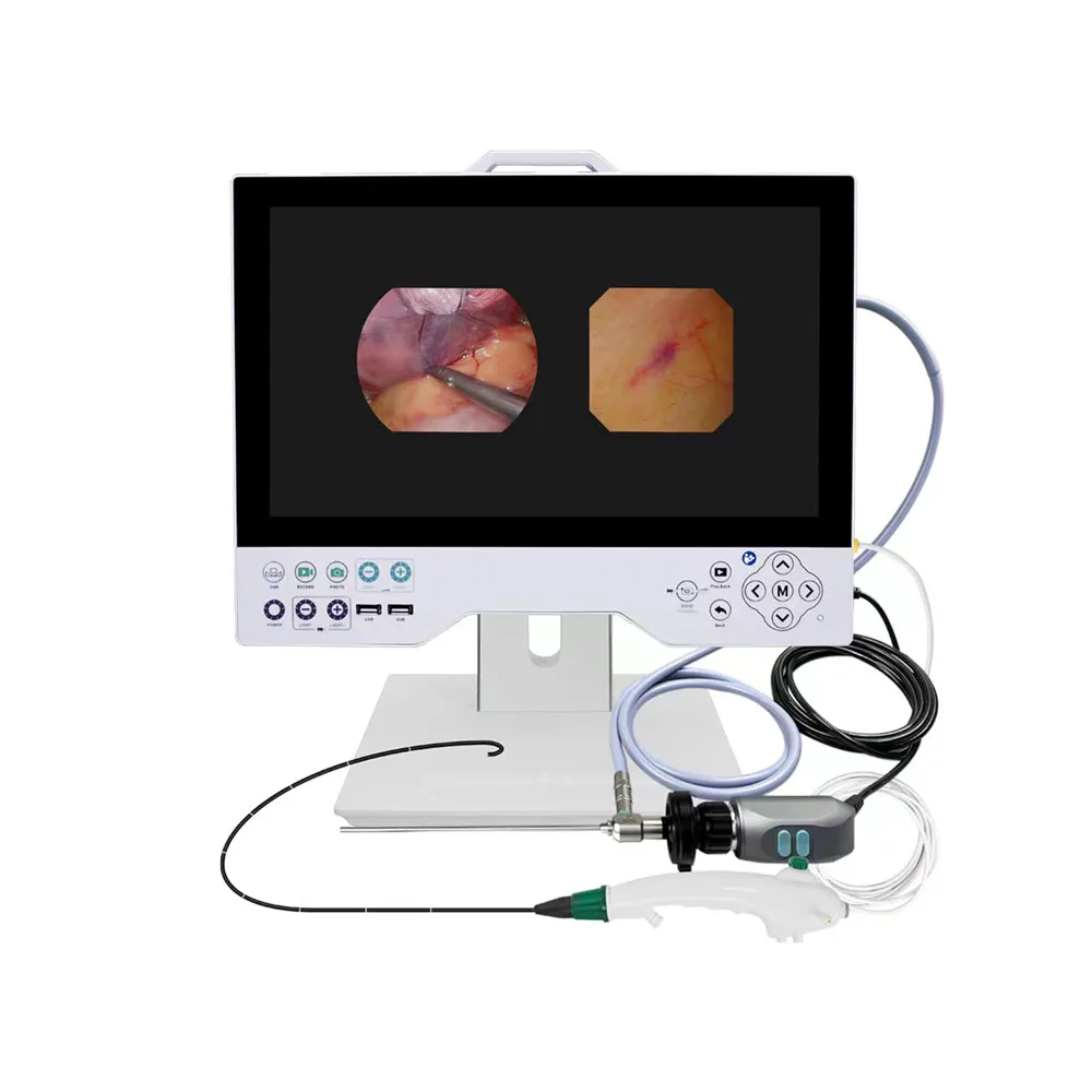 TU-24LSD1E Video Endoscopio ORL Endoscopio HD per otolaringologia Rinoscopio Sinuscope Laringoscopio