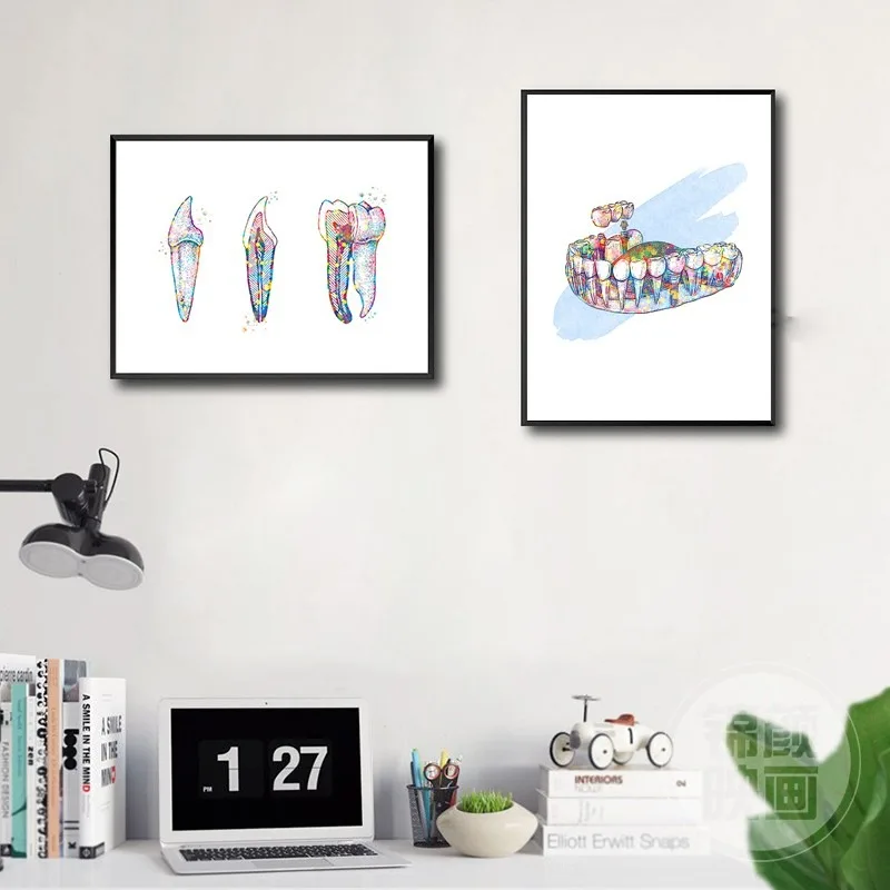 Tooth Implant Oral Clinic Medical Anatomy Posters Pictures Canvas Wall Art Home Decor Paintings for Living Room Decoration