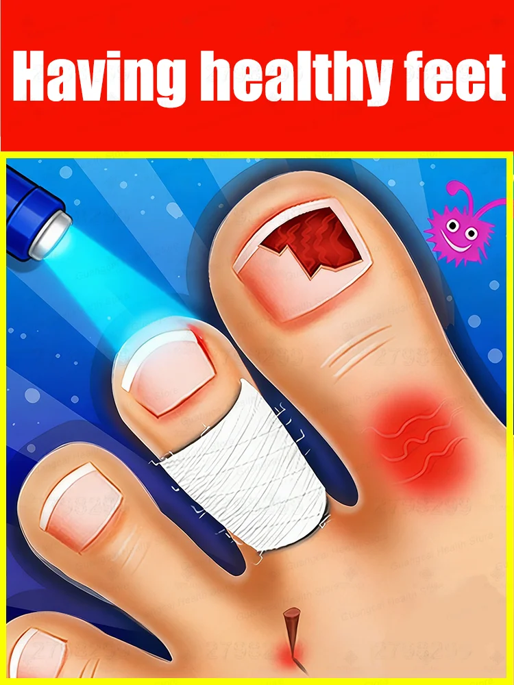 

Blue light laser pen ᵗʰᵒʳᵒᵘᵍʰˡʸ ʳᵉᵐᵒᵛᵉˢ ᶠᵘⁿᵍⁱ⸴ ᑫᵘⁱᶜᵏˡʸ ᵉˡⁱᵐⁱⁿᵃᵗᵉˢ ᶠᵘⁿᵍⁱ⸴and restores nail health.