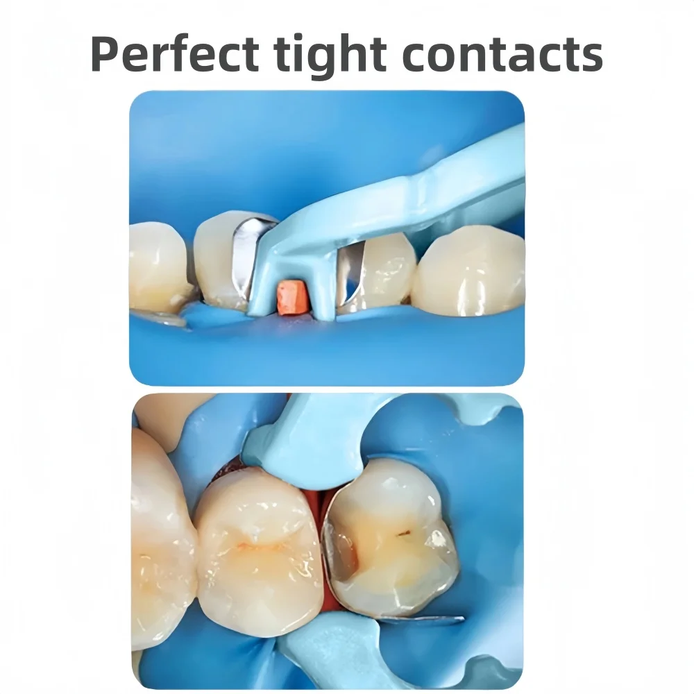 

Держатели стоматологической роторной пасты — спиральный наполнитель в ассортименте для лечения корневых каналов, эндопаста, инструментов для наполнения двигателем и стоматологии