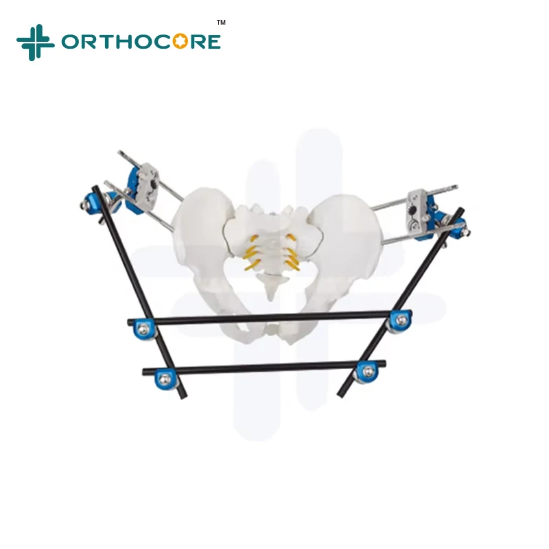 Hoffman System Pelvic External Fixation Surgical Instruments