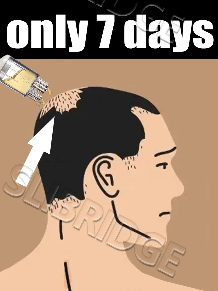 

Wake up sleeping hair follicles,Scalp Applicator Liquid Comb,Liquid Guiding Massager, Hair Growth Serum Oil Apply,luxuriant