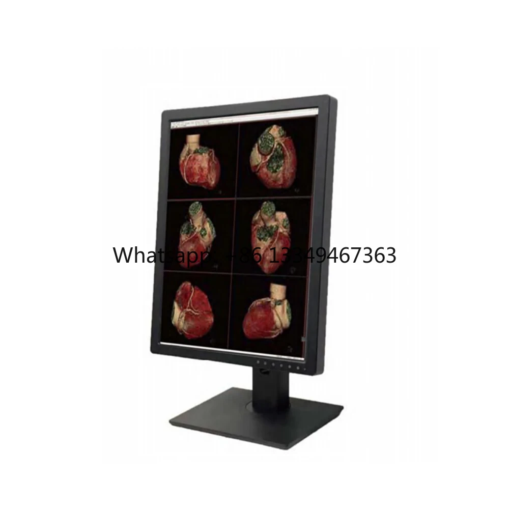 En stock MY-D076A-2 Venta caliente Pantalla de computadora médica LED para la cirugía general de la torre Venta caliente