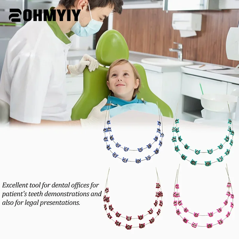 

2Pcs Cartoon Cat Dental Metal Braces Archwire Without Hooks Metal Bracket And Ligature Ties Colorful Temporary Tooth Decoration