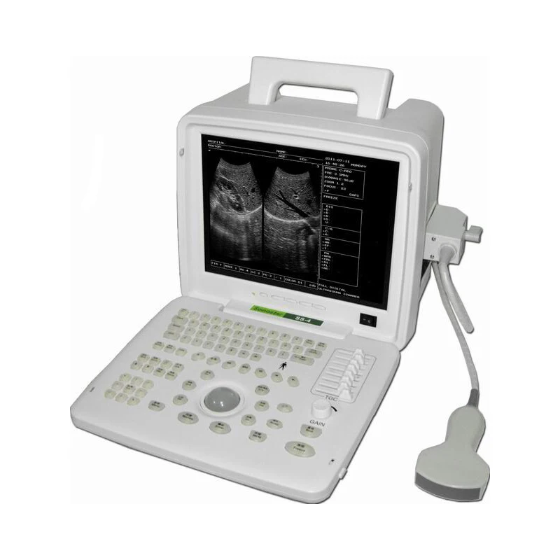 GooDoctor Notebook Full Digital Ultrasonic System Long Running Hour Lightweight Human Ultrasound Machine