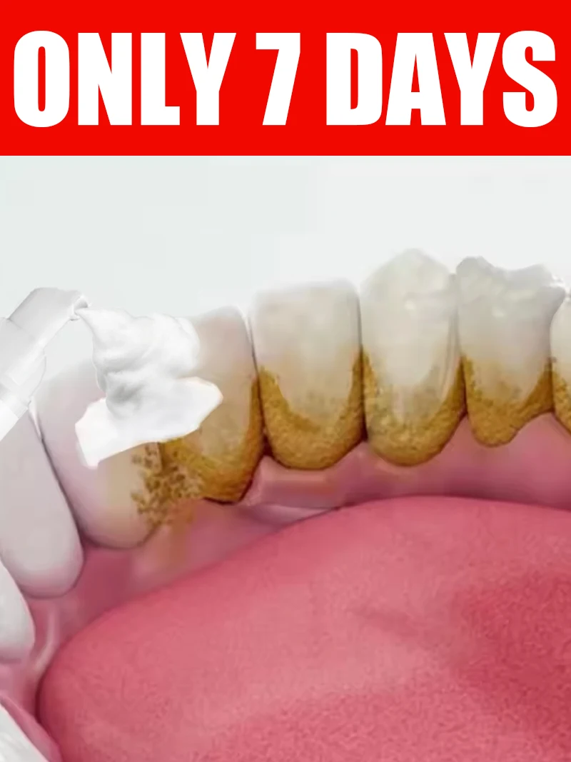 

Новинка 2026: Усовершенствованная щетка для удаления зубного налета – инструмент для ухода за полостью рта