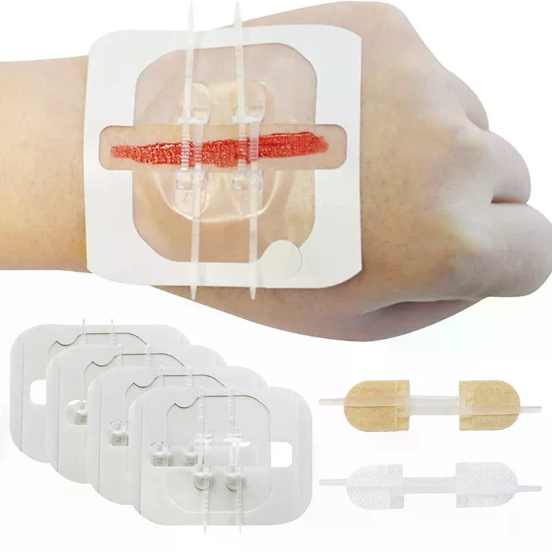 Бандажные полоски с застежкой-бабочкой, клейкая строчка для ран, антипригарная подушечка для кожи, 1/3/10/50, пластыри - медицинская повязка для резей и ломтиков