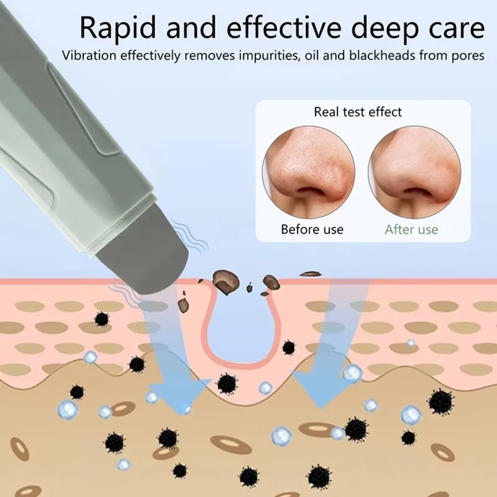 Herramienta de eliminación de espinillas faciales de limpieza profunda, elimina puntos blancos, acné, exfoliante, raspador de espinillas, eliminador de sebo de mano