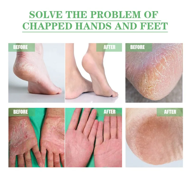 Chapped Protective Hand Foot Cream Anti peeling exfoliation Repair Skin Heel Anti-Dry Crack Removal Dead Skin Moisturizing Care