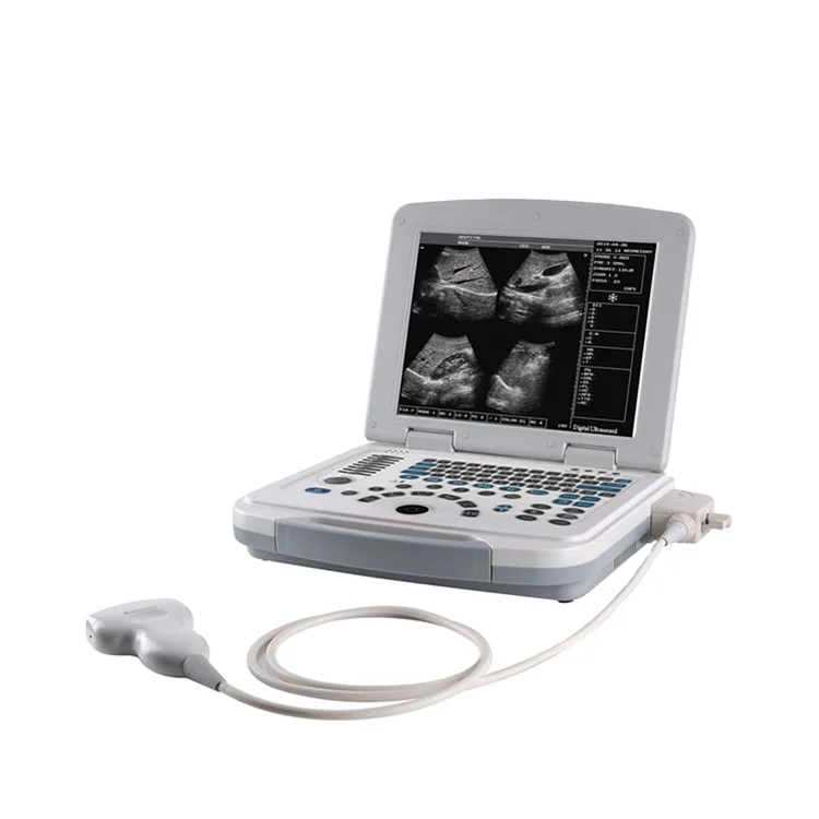 

BT-UD580 medical hospital digital black and white cheapest portable human ultrasound machine scanner prices