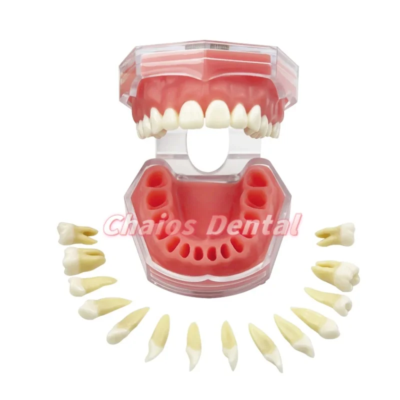 1Pcs Extraction Model Dental Standard Typodont Model Soft Gum With 28 Removable Teeth Adult Practice Model For Dentist Teaching