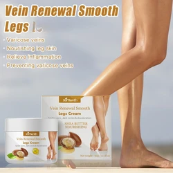 Effective Varicose Vein Relief Cream Ointment For Varicose Veins To Relieve Vasculitis Phlebitis Spider Leg sore Pain Treatment