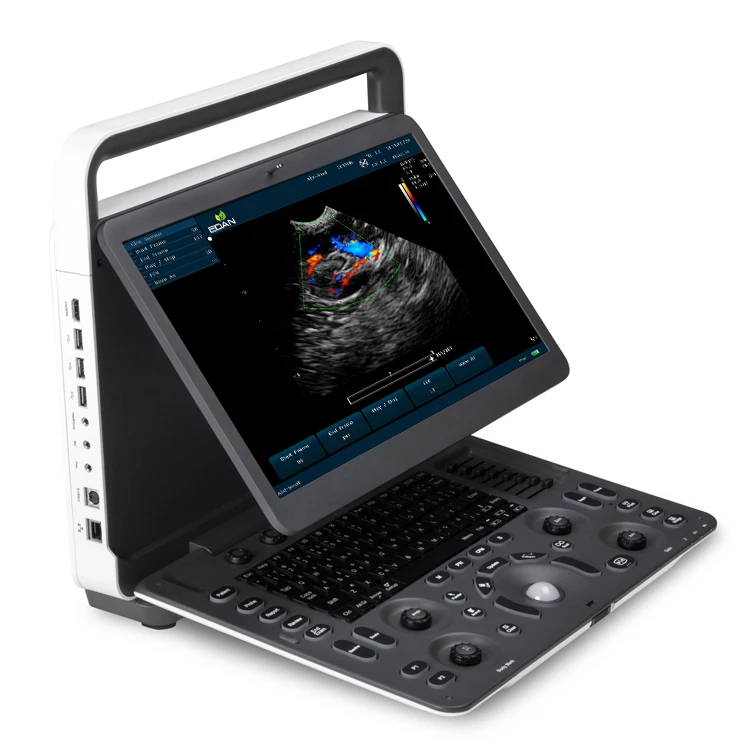 sonoscape e1 exp expert machine 4d ultrasound