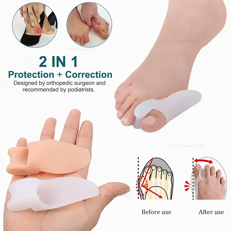 Corretor de polegar de silicone macio, 2 peças, joanete, pé, hálux valgus, protetor, separador, ortopédicos, ferramenta de cuidados com os pés, inserções