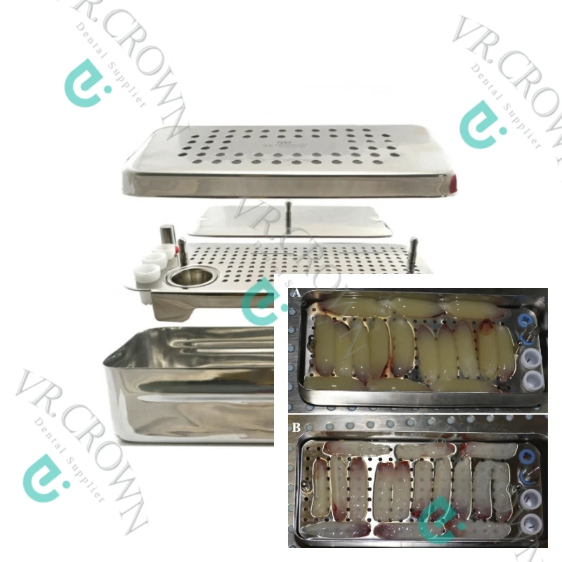 PRF Box Dental GRF System Platelet Rich Fibrin Set Implant Surgery Membrane Kit PRF Membrane Box PRF