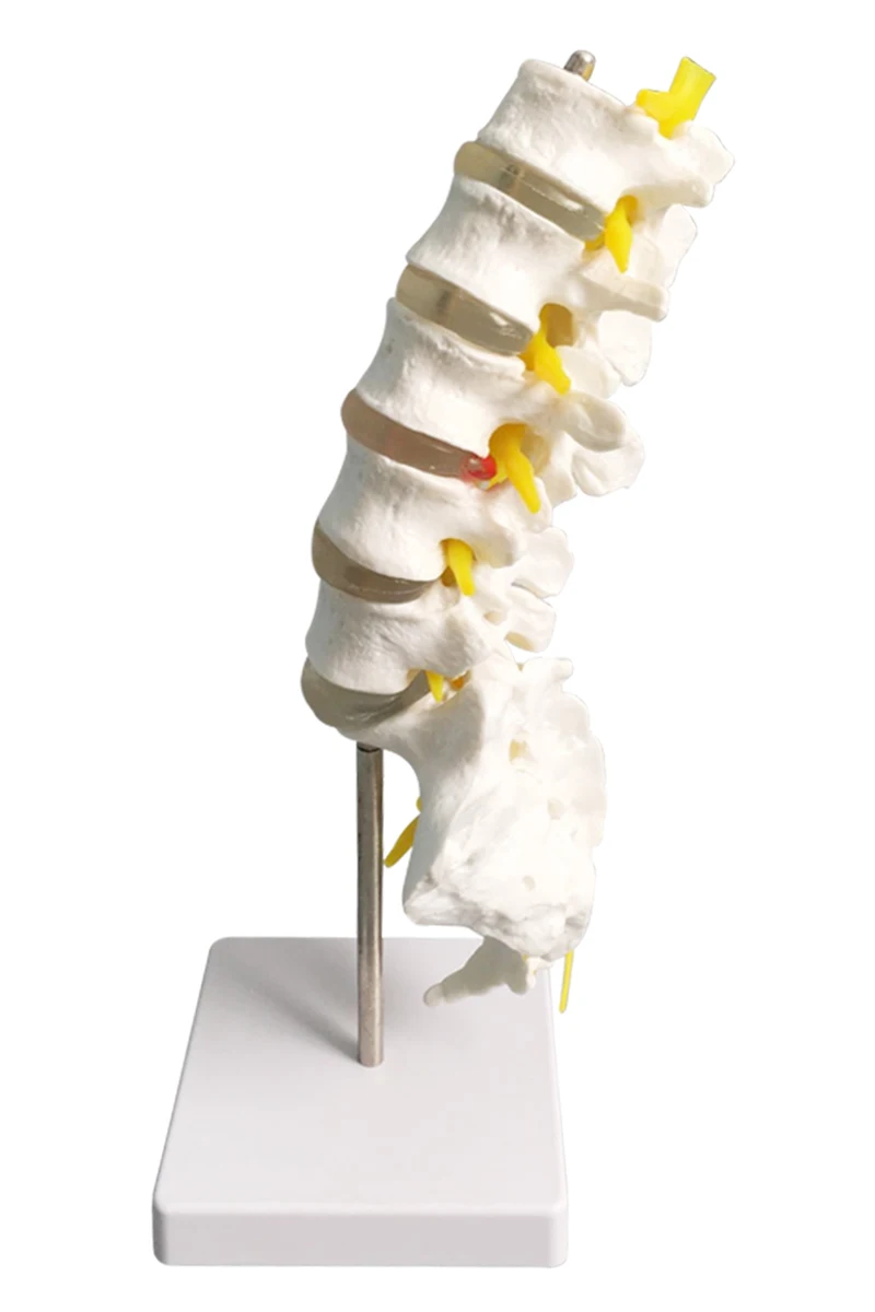 16CM Human Sized Lumbar Spine Anatomical Model and Sacral and Spinal Nerve Medical Research Teaching Tools