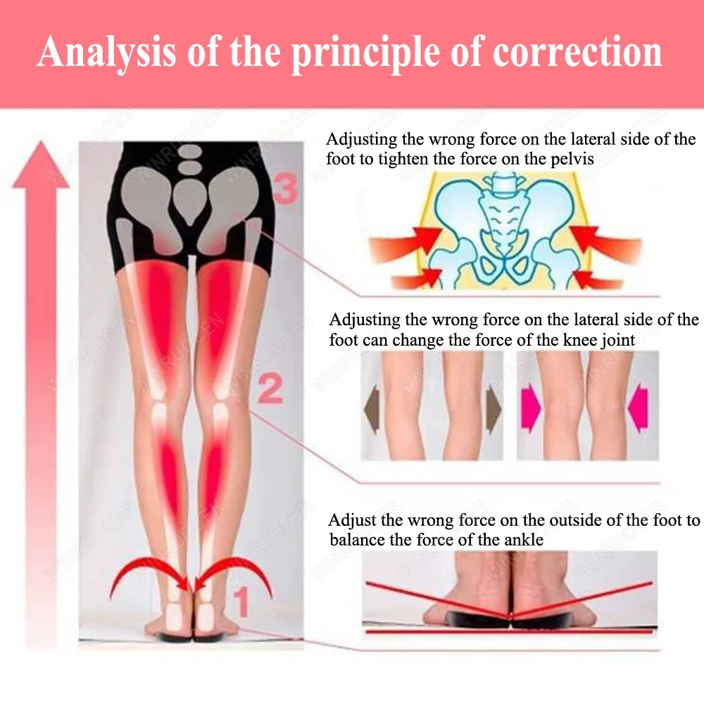 Flat Foot Massaging Cure Corrector Gel Insole O/X Type Leg Arch supports Feet Pain Care Varus Orthopedic Correct Shoe Insoles