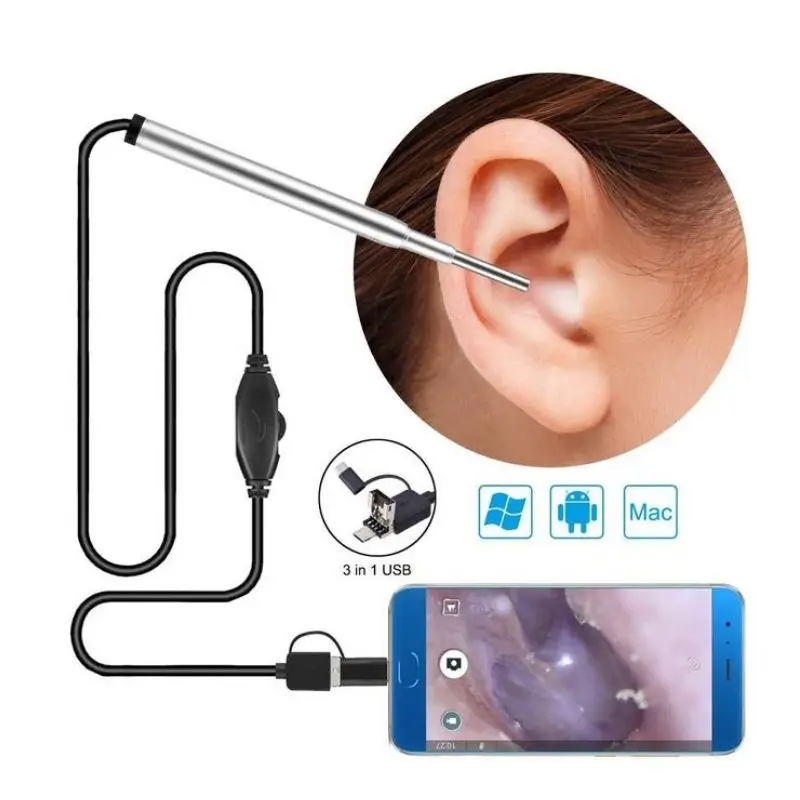 3.9mm 720P Ear Spoon Cleaning Tool 1.3MP Android Type C USB Medical Otoscope Inspection Camera Ear Nasal Earpick Endoscope