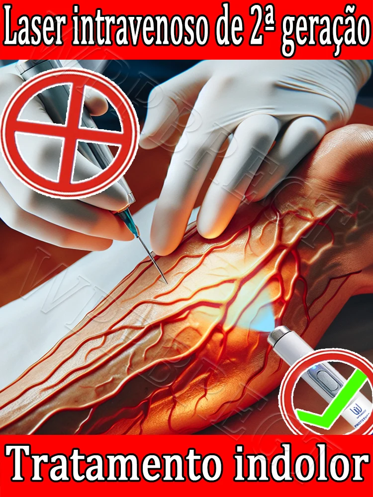 

Products for treating varicose veins