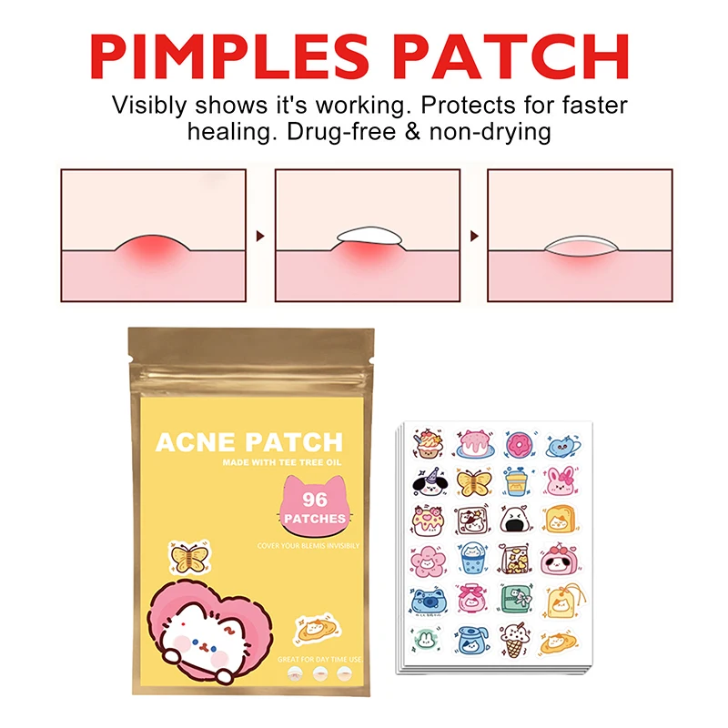 96Pcs Acne Patches Cartoon Cat Shaped Acne Treatment Sticker Invisible Acne Cover Removal Pimple Patch Skin Care