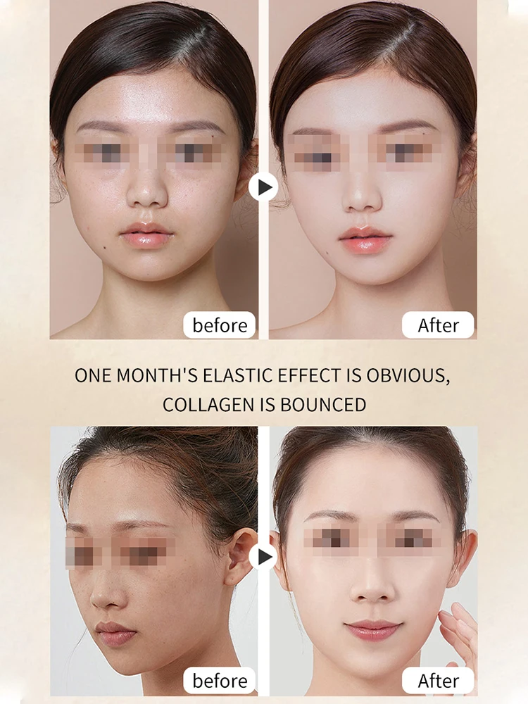 Hifu 超音波フェイスリフティングマッサージャーアイケア美容機器ホームスパしわ除去アンチエイジング肌引き締め