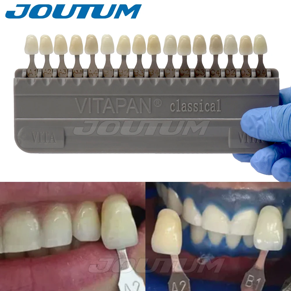 Denspay معدات طب الأسنان تبييض الأسنان الخزف VITA عموم الكلاسيكية 16 ألوان دليل فيتا نموذج الأسنان نموذج لوحة الألوان