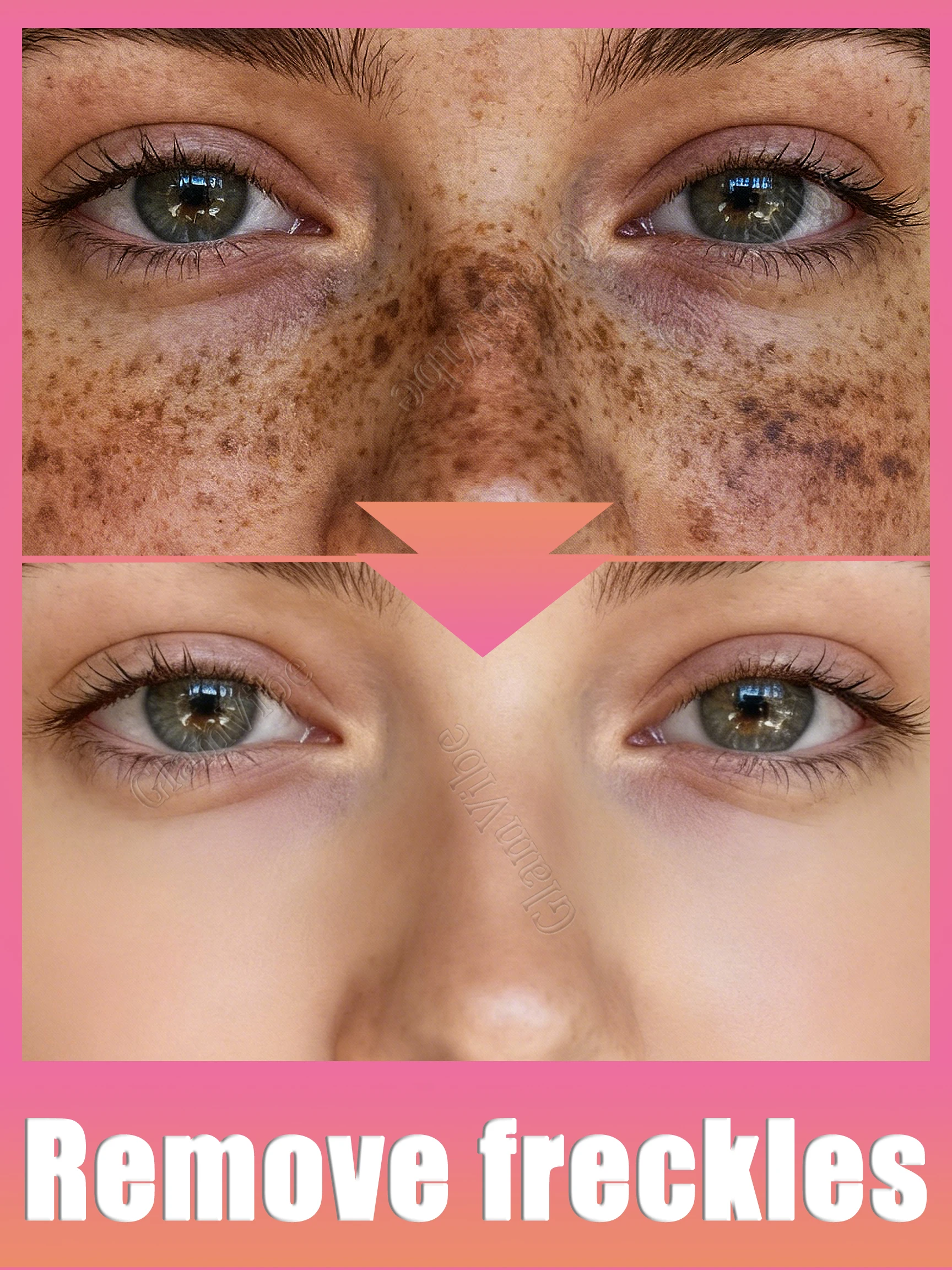 

Электрический аппарат для удаления родинок, бородавок и папиллом, коррекции пятен