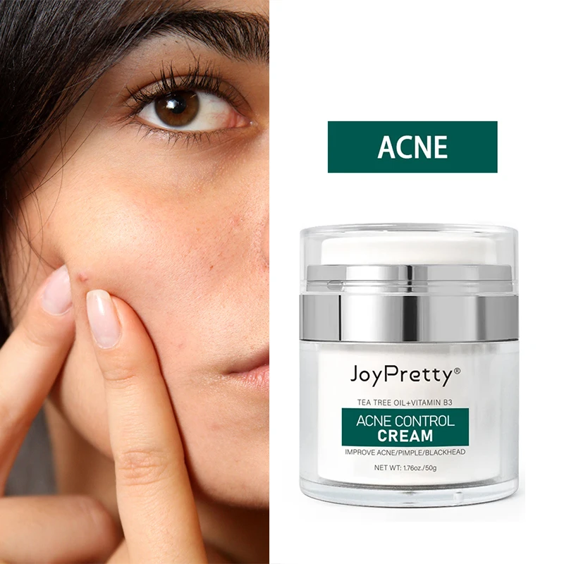 

Acne Face Cream Pimple Scars Treatment Black Dots Removal Facial Oil Control Shrink Pore Creams Skin Care Product