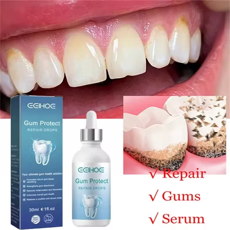 Rapid Repair Gums Serum Effectively Relieve Tooth Allergy Dental Caries Tooth Cleaning Relieve Tooth Damage Drops Toothpaste New