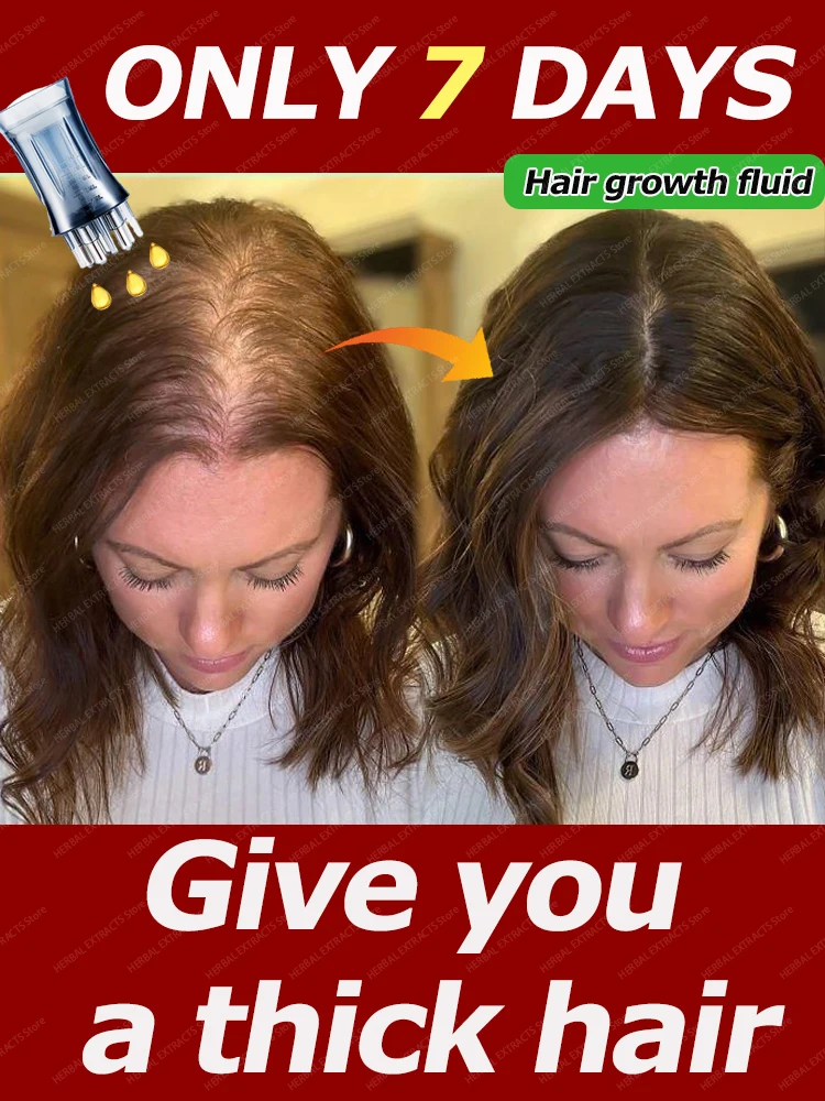 Dies ist ein absolut das effektivste Haarwachstumsprodukt des 21. Jahrhunderts, das millionenjährigen Menschen hilft, die von ha loswird haben