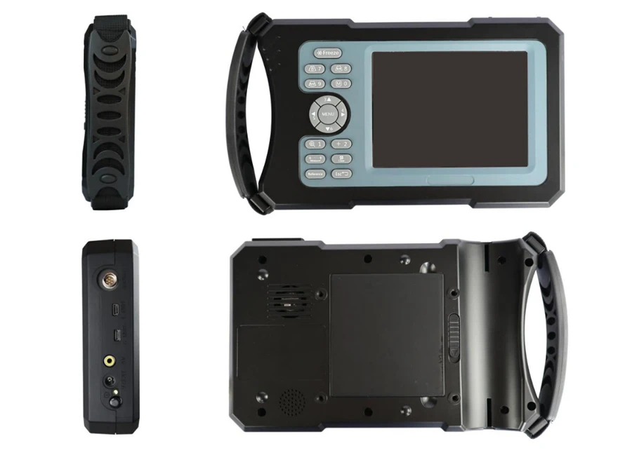 Highest Cost-effective Handheld Portable 3 in 1 Wifi & USB Wireless Ultrasound Probe