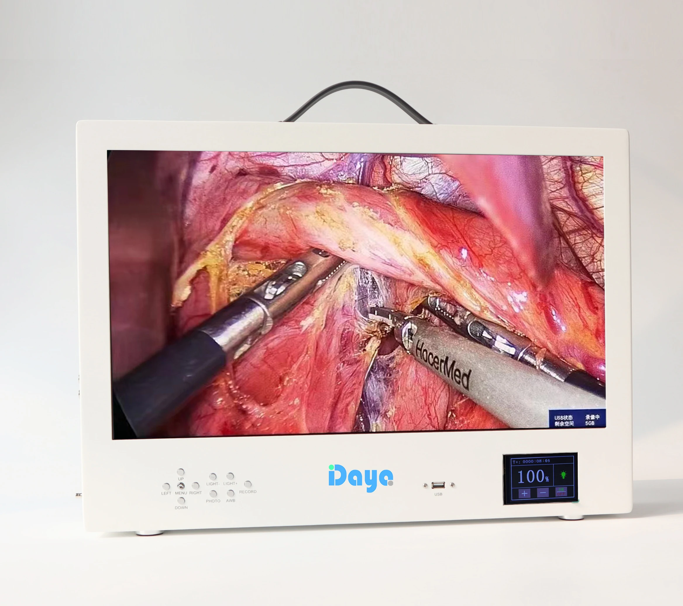Portable FHD All-in-One Endoscope Camera System for ENT Urology Gynecology Electric Power Source