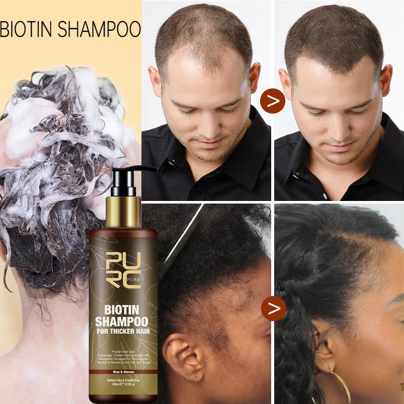 مجموعة شامبو وبيوتين لنمو الشعر لللحية، إعادة نمو سريع، بصيلات صحة فروة الرأس، تعزيز العناية بالشعر، أساسيات التجميل