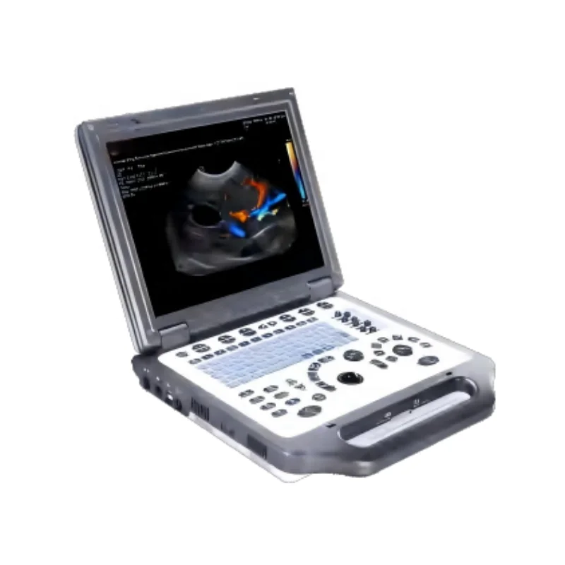 USMILEPET Veterinary Doppler Ultrasound Diagnostics Vet Monitoring Ultrasound Machine with  Doppler Ultrasound