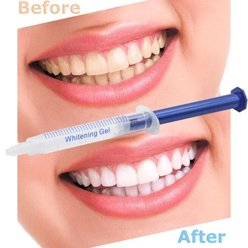 5 Pcs Teeth Whitening Gel Light Dental Equipment 44% Peroxide Bleaching Clareador Dental Gel Pens Wholesale Teeth Whitening Kit