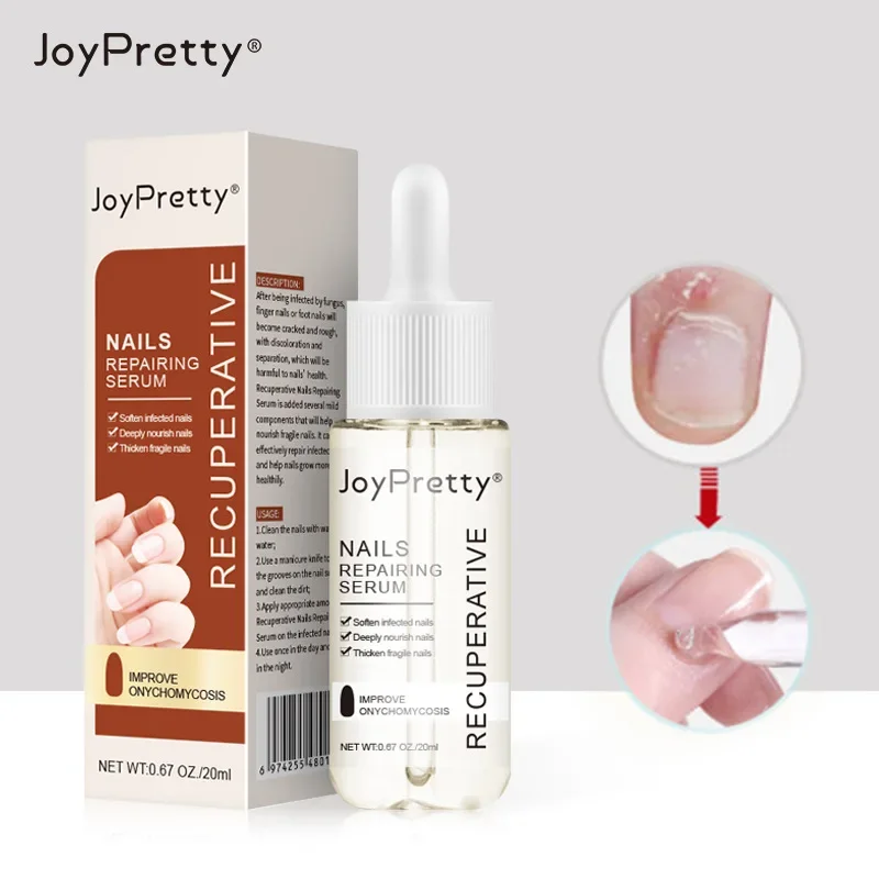 

발톱무좀 Nail Repair Liquid Nails Serum Fingernail Solution Toenail Nourishing Strength Care Essence Repairing Damaged Growth