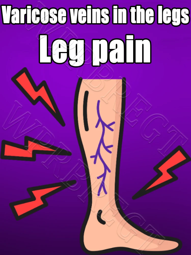 

Прибытие новой техники: лечение варикозного расширения вен в себя эпоху «прецизионного ремонта».