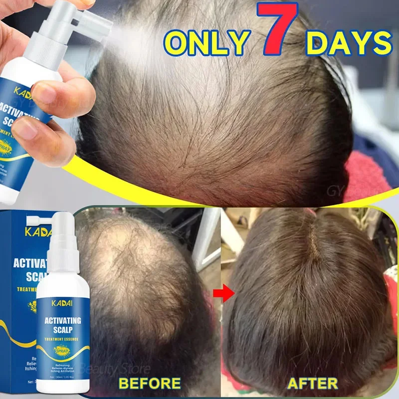 

Fast Hair Growth Spray Serum Anti Hair Loss Oils Prevent Baldness Treatment Scalp Dry Damaged Beard Beauty Hair Care Men Women