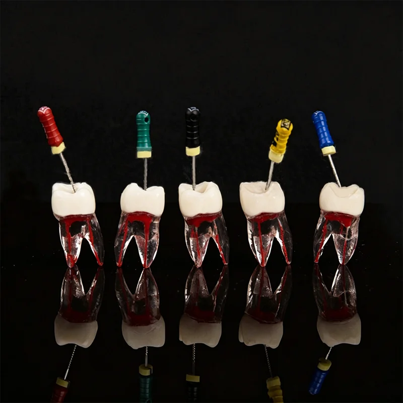 Dental Teeth Root Canal Model Pulp Opened Cavity Endodontic Practice RCT Block Endo File Resin Tooth Typodont Study