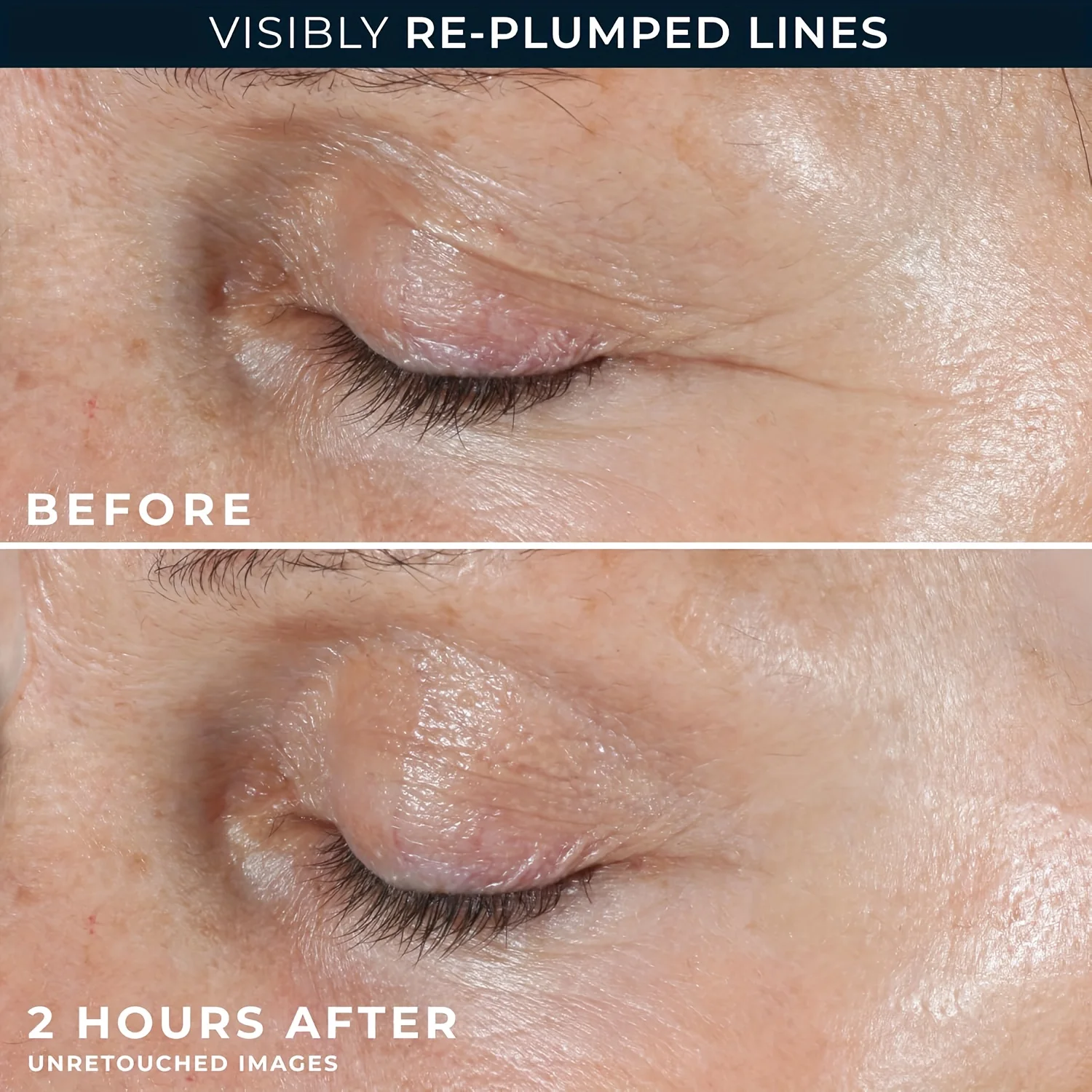 2PCS 레티놀 마이크로니들 아이 패치(≤0.3mm)는 - Microneedle Patch Eye 리뷰 및 가격