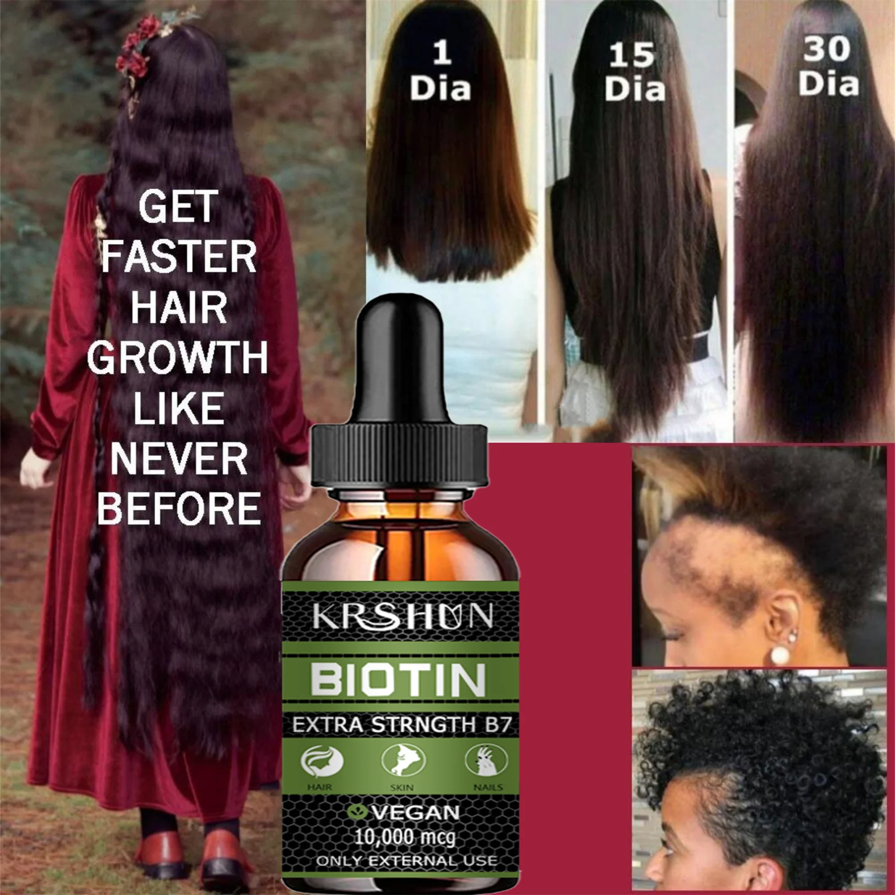 Biotin Fast Hair Growth Oil Hair Regrowth Serum Hair Thinning Treatment Hair Growth Liquid Anti-Hair Loss for Women & Men