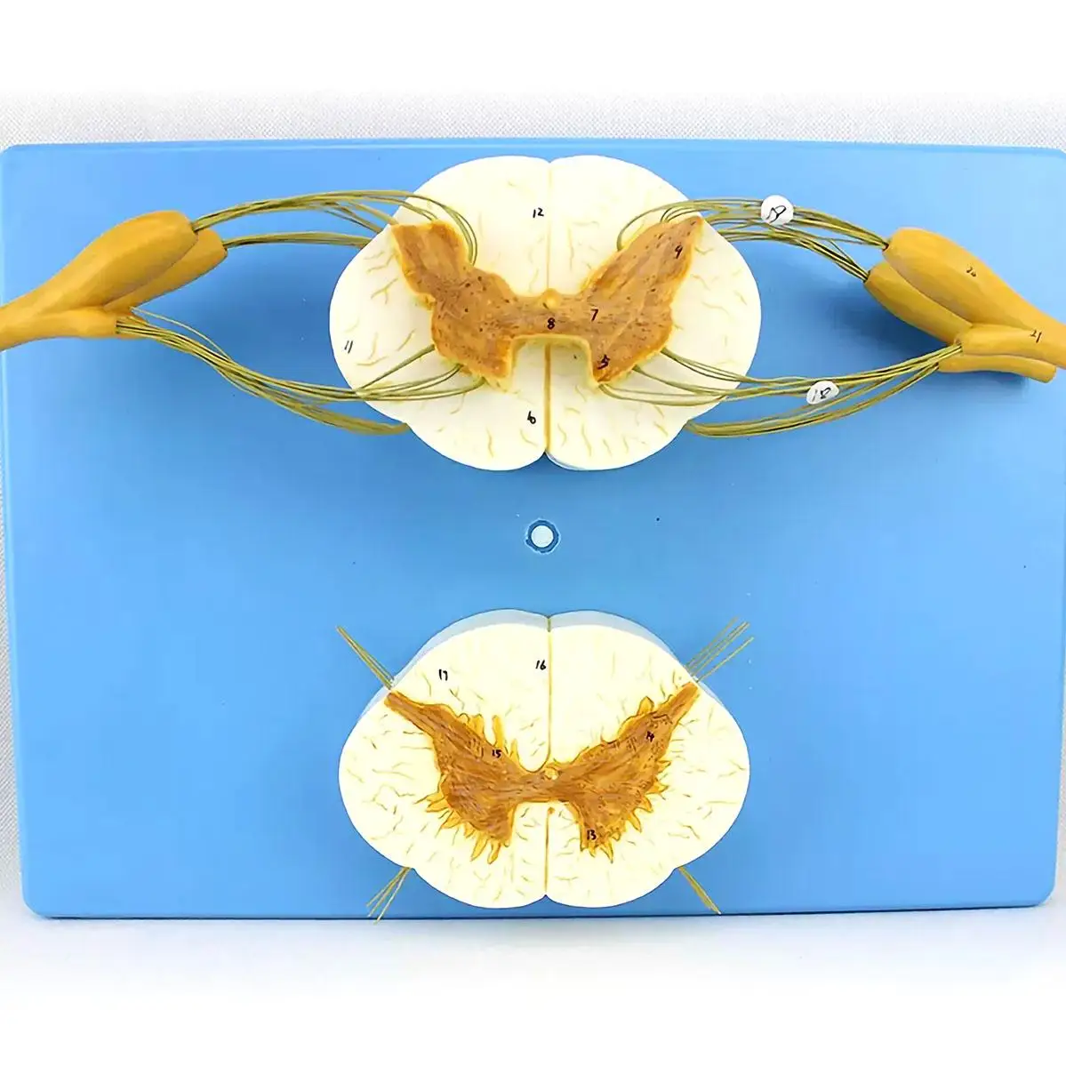 2 Parts Human Spinal Nerve Cross-section Of The Spinal Cord Model Medical School