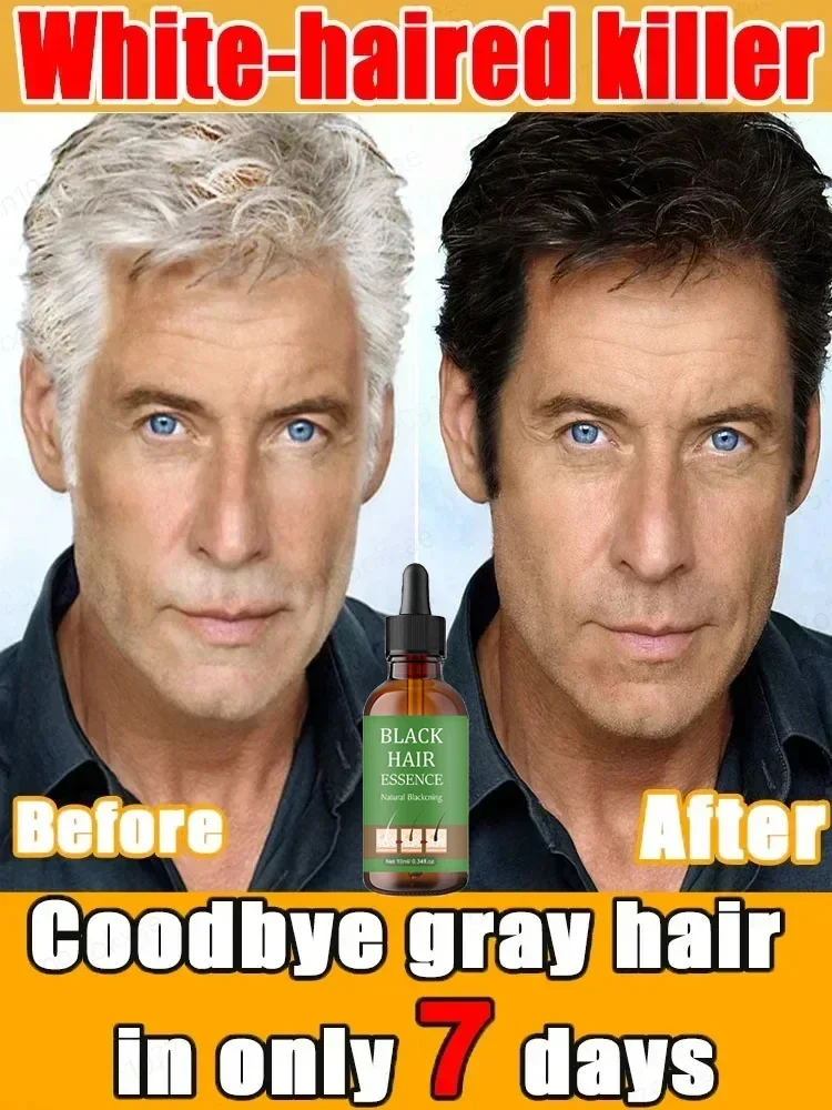 

Natural Anti Gray Hair Serum - Repair White & Darkening Hair | Nourishing Hair Care Remedy