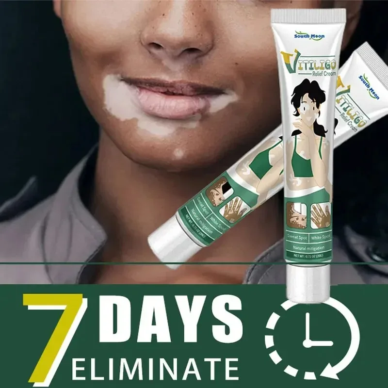 Vitiligo Ointment Herbal Extract Remove Ringworm White Spot Removal Skin Vitiligo Eliminate Vitiligo Treatment Cream