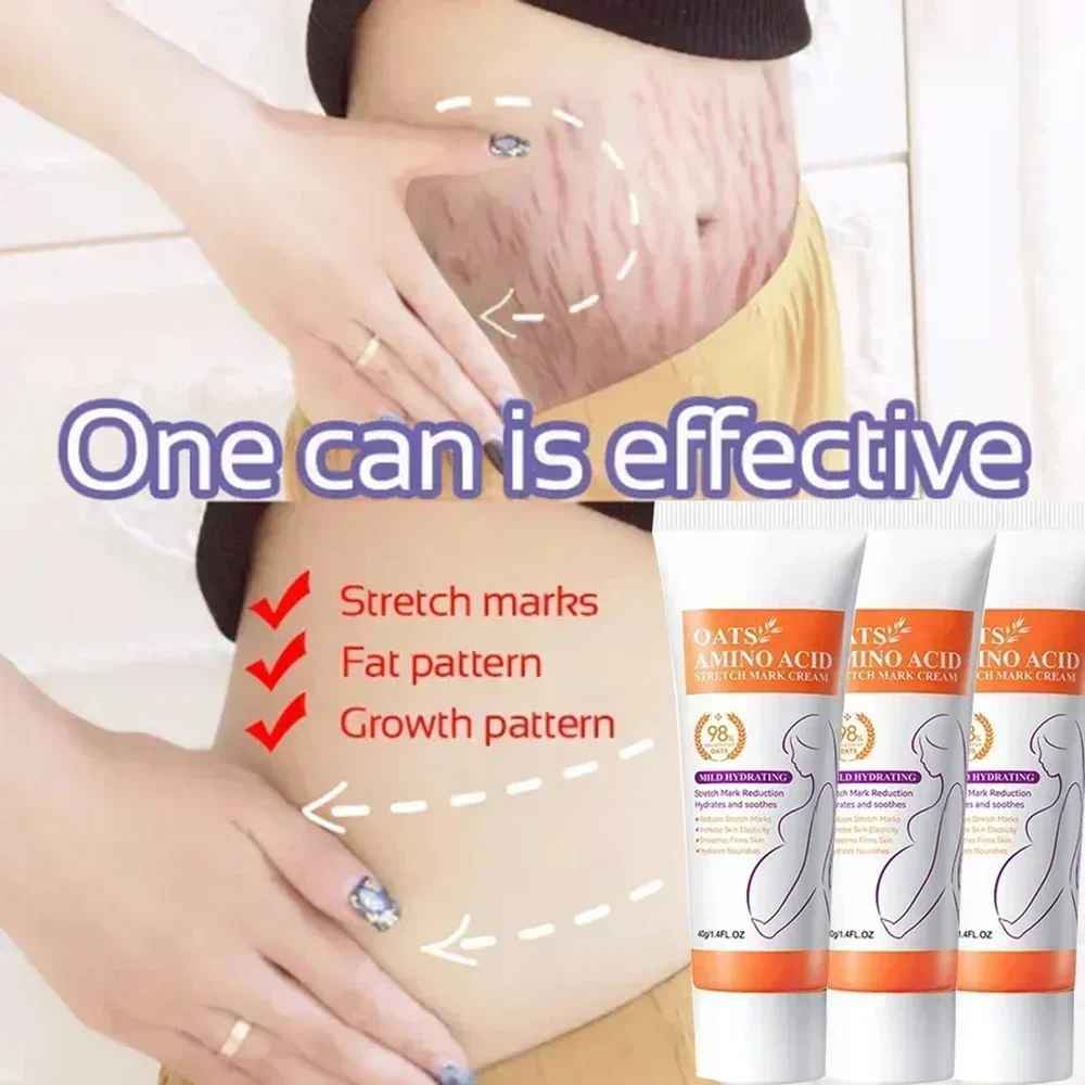 ²⁰²⁵ Removes Stretch Mark Cream To Remove Postpartum Obesity Pregnant Women Repair Anti-Aging Winkles Firming Body Cream Skin Ca