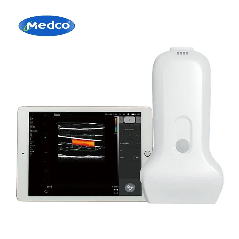 Portable 3 in 1 wireless ultrasound probe smartphone wifi linear Convex ultrasound probe