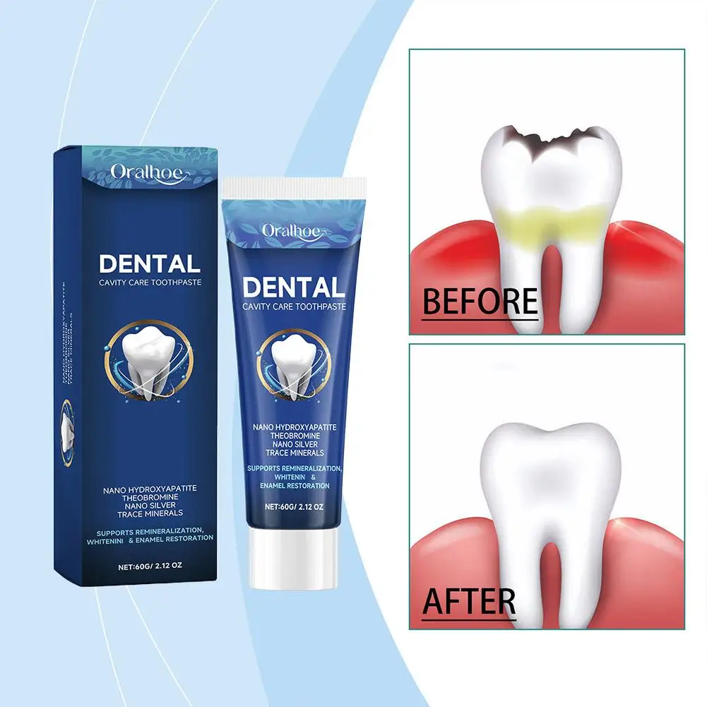60g Teeth Care Toothpaste Freshing Breath Deep Cleaning Hygiene Oral Hygiene Sensitive Removes Stains Plaque Teeth Oral M6B5