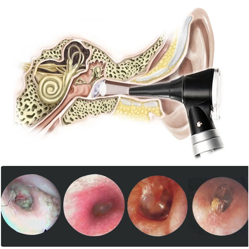 Professional Fiber Optical LED Otoscopio ENT Diagnostic Borescope Medical Ear Check Endoscope Light Portable Direct Otoscope Set